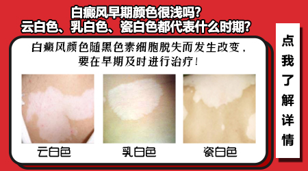 病因病理-白癜风疾病的诱发因素是什么